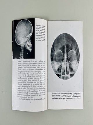 X-Rays and You