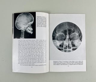 X-Rays and You